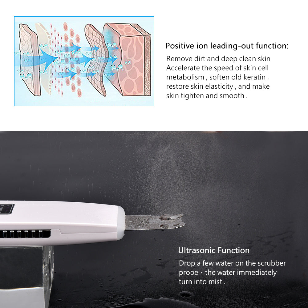 Ultrasonic Pore Vacuum Cleanser – photo 4
